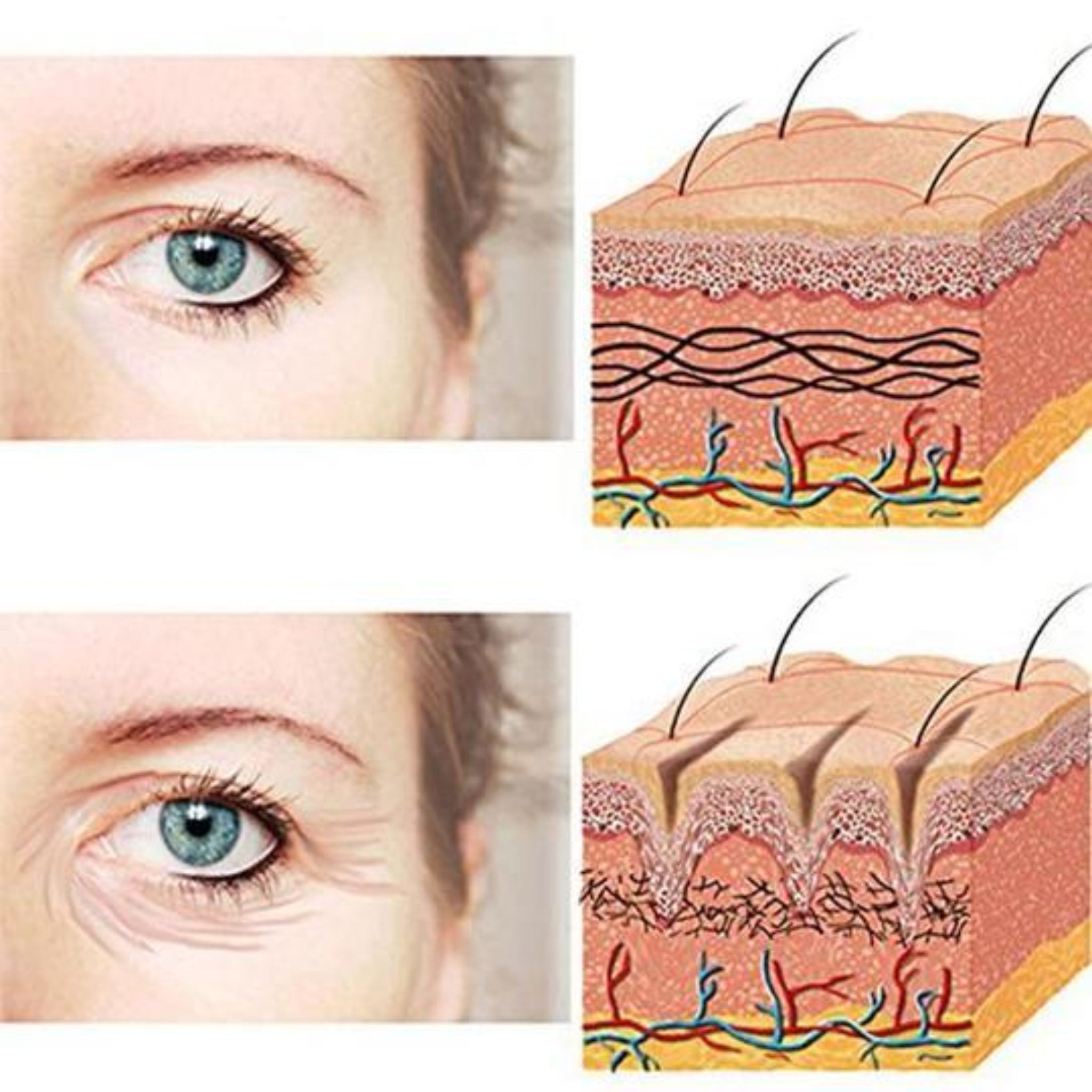 Anti Wrinkle Face Patches