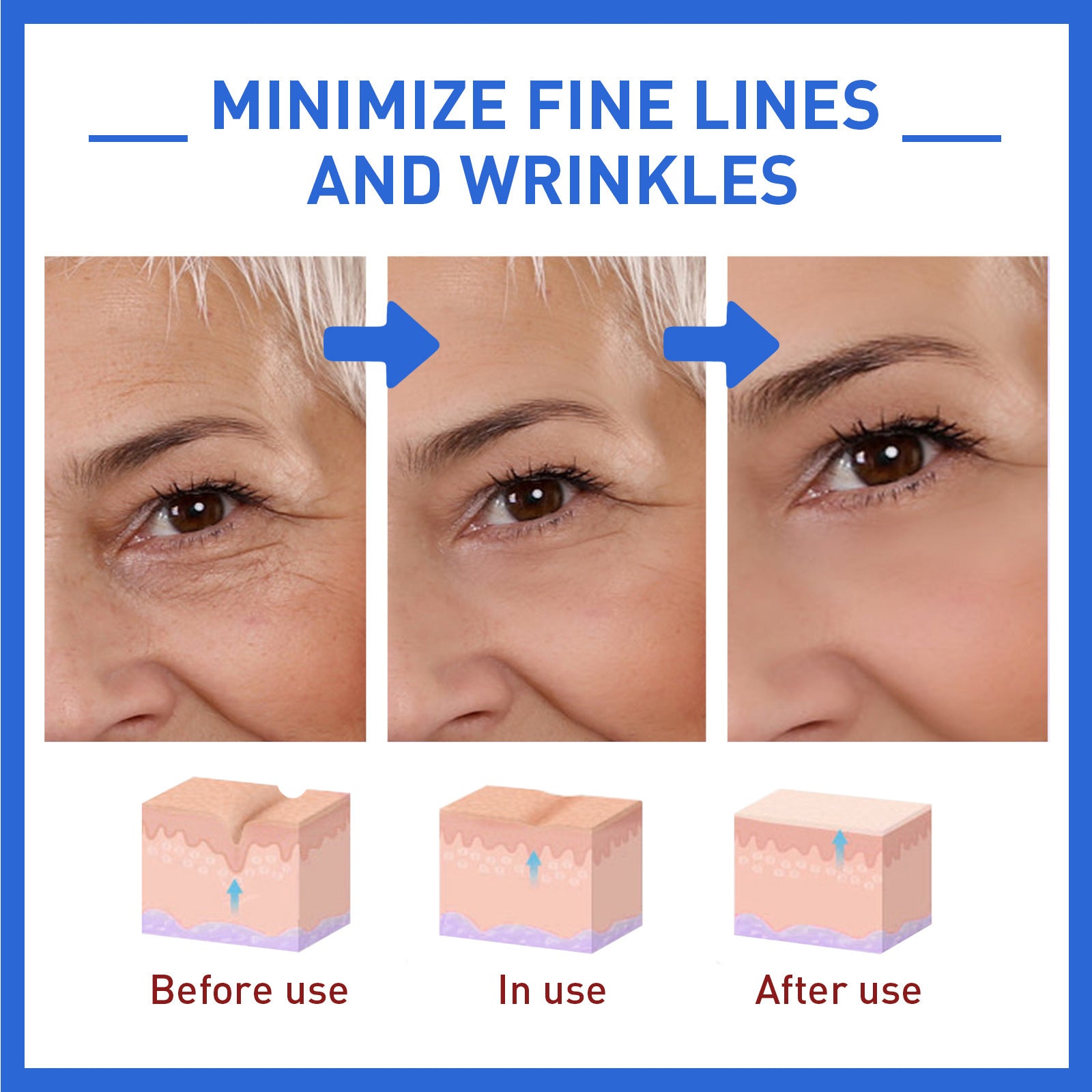 Anti-Wrinkle Firming Lifting Fading Botox